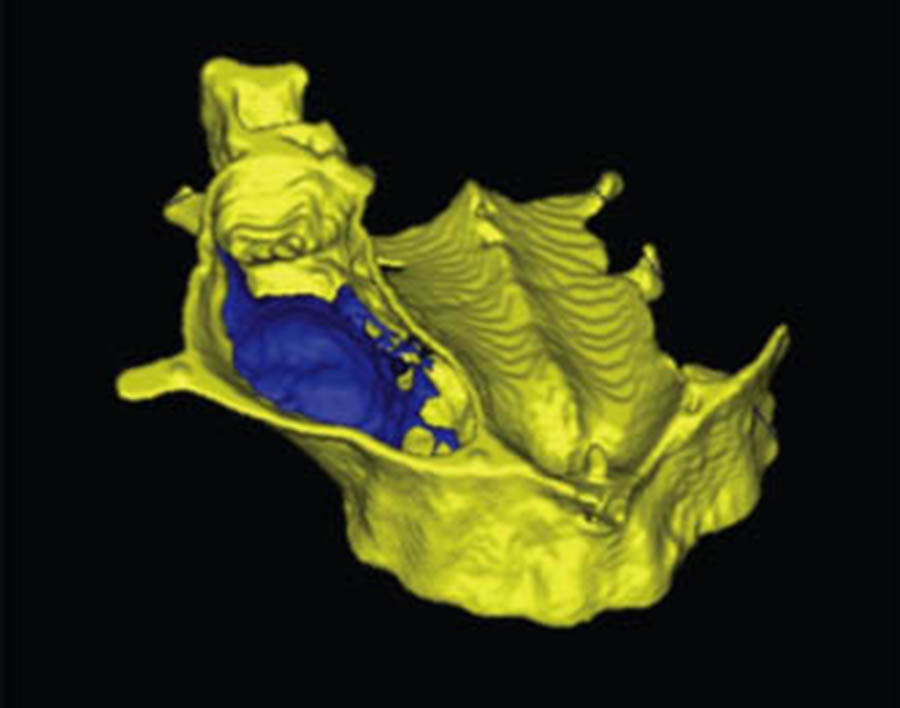 ct scan of jaw