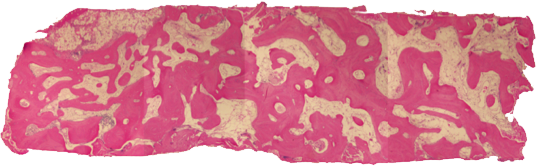 bone tissue image