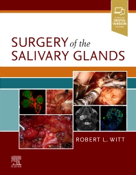 surgery of salivary glands book cover